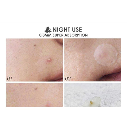 Acne Pimple Patch